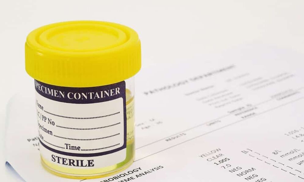 Prima di assumere antibiotici è necessario eseguire un esame delle urine